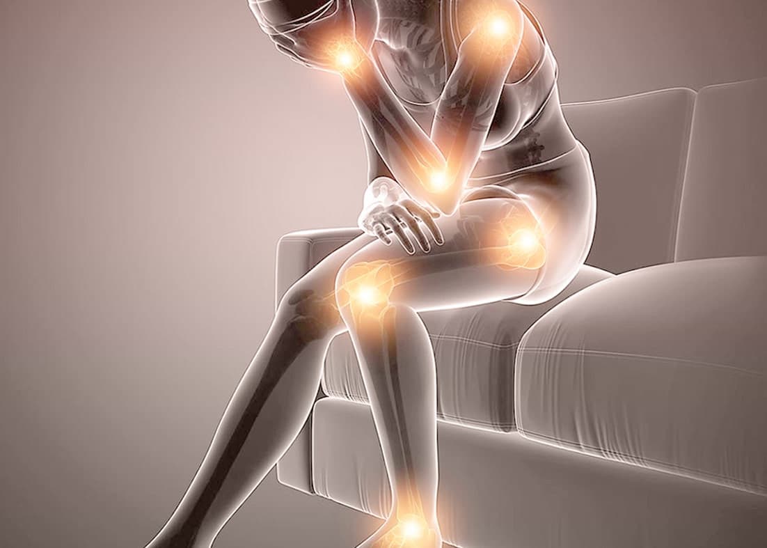 Imagem ilustrativa sobre Fibromialgia na reumatologia