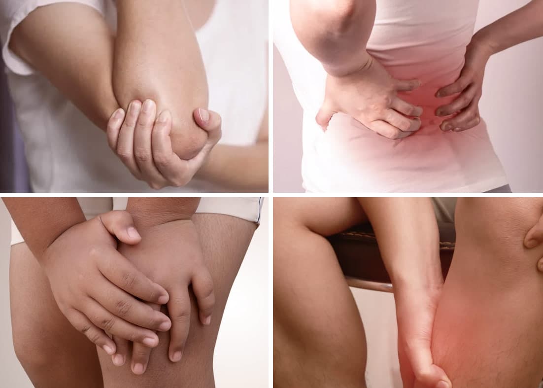 Imagem ilustrativa sobre Miosites na reumatologia